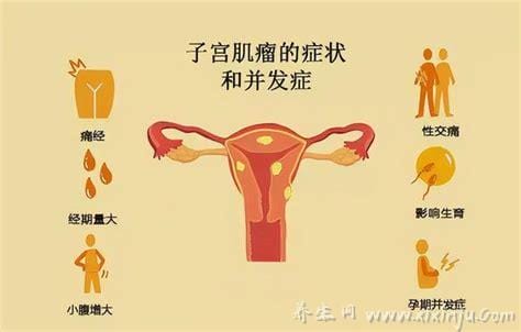 女人得性疾病什么症状,白带增多/外阴瘙痒/身上有很多红点等