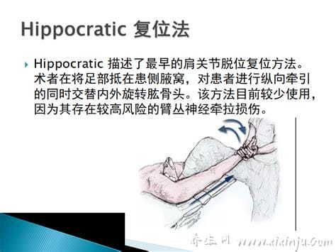 ​肩关节脱位复位的几种方法,踏板复位法/椅背法/重力牵引法