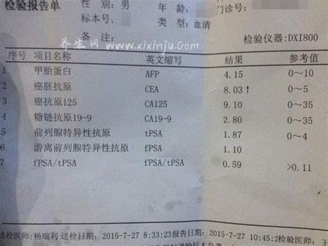 癌胚抗原检查费用多少钱,一般在100元-300元之间