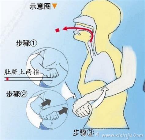 海姆立克急救法示意图,希望每个家长必须学会