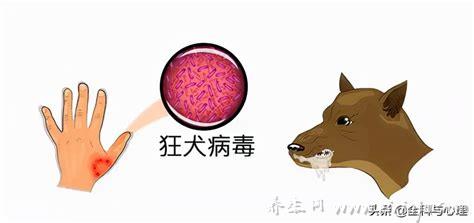 狂犬疫苗最佳时间是多少小时内,是24小时内药效是最好