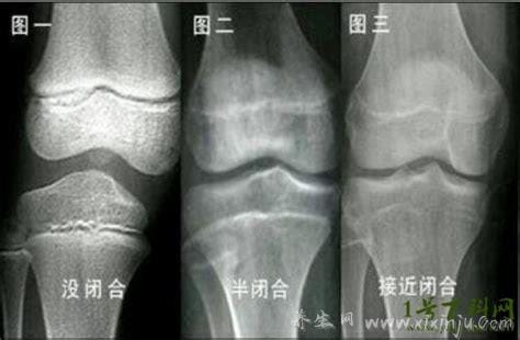 8个征兆说明停止长高,脚的大小不变/体重开始增加都是征兆