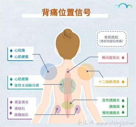 人体器官后背疼痛对应器官图,9处致命的心脏疼痛位置图