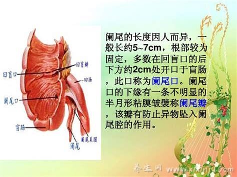 阑尾在哪个位置？阑尾炎是哪个部位疼图片,注意可转移右下腹疼痛