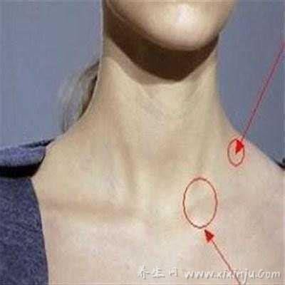脖子淋巴癌早期症状图片,淋巴结肿大无痛感光滑(有发热消瘦现象)