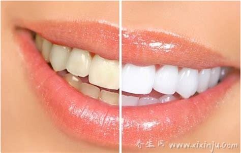 牙黄变白最实用的方法,五种方法教你拥有一口健康大白牙