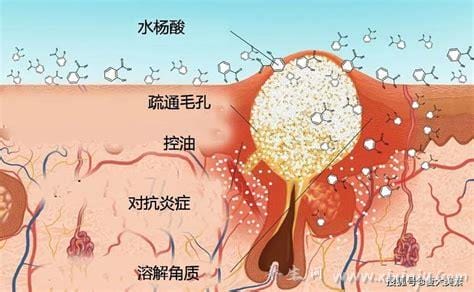 果酸和水杨酸对皮肤有什么作用(用果酸水杨酸的副作用是什么)