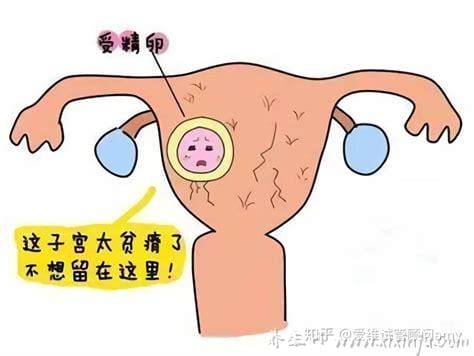 子宫内膜脱落真正图片,像血块有肉感为正常现象(附与孕囊对比)