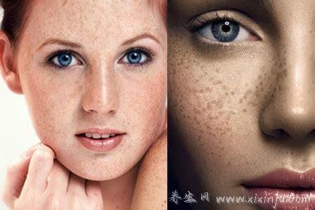 脸上长斑是身体哪个部位出了问题,女人长斑的位置图解