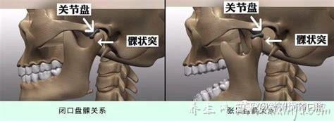 颞下颌关节紊乱综合征 概述