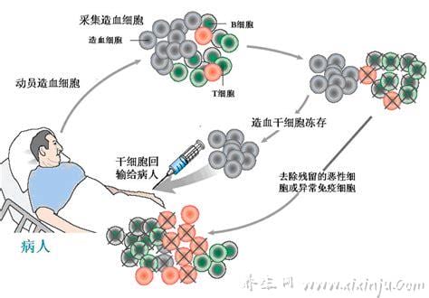  白细胞减少症的治疗