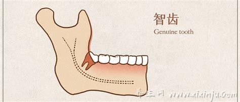  长智齿牙疼吃什么药