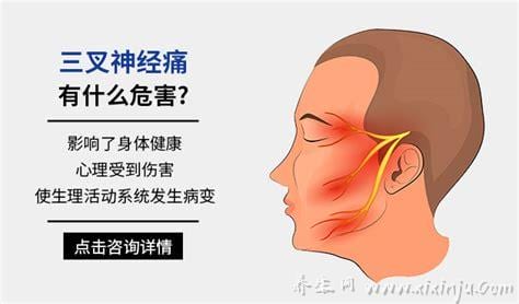  三叉神经痛是什么原因引起的