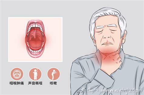 病毒性咽炎有什么症状