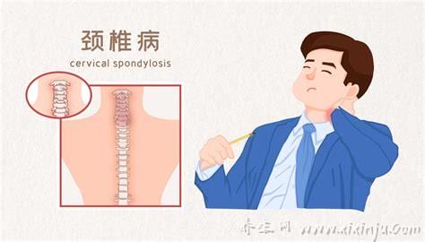 脊髓颈椎病是大手术吗