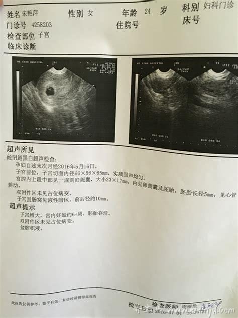  睾丸b超要怎么做