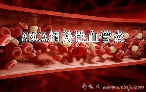 什么是ANCA相关性血管炎