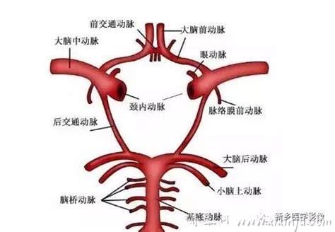 大脑前动脉发育异常