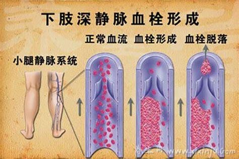 硬化剂对人体有伤害吗