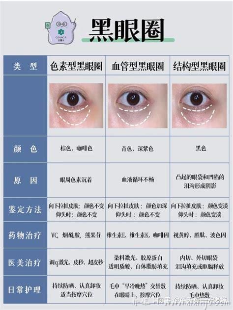 男性长期黑眼圈小心哪五种疾病