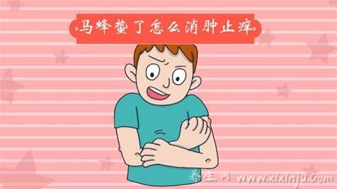  蜜蜂蛰了怎么消肿止痒