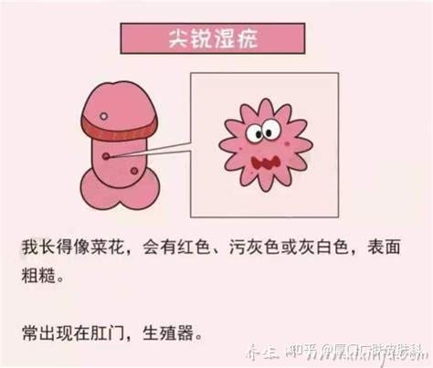  性病能治好吗