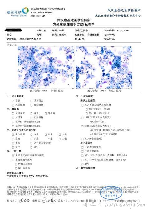  病理检查多久出结果