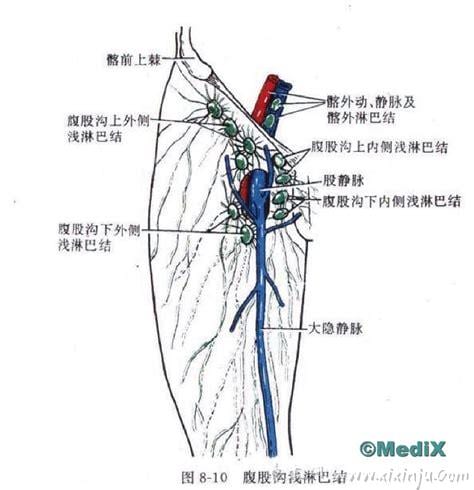  腹股沟淋巴癌征兆