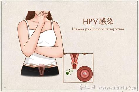 乳头感染HPV图片