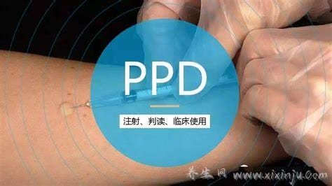 ppd试验结果判断标准