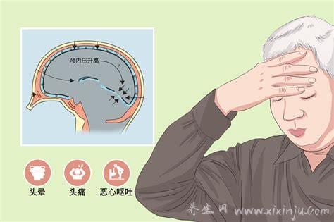  颅内压增高的临床表现