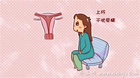  为什么不建议女人上环