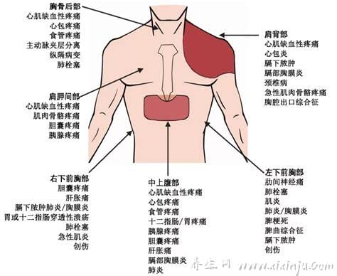  左胸下方隐痛什么原因