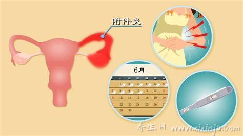  子宫附件炎的症状