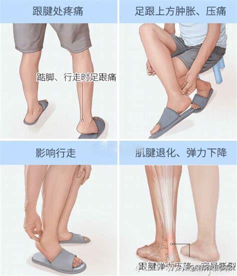  跟腱周围炎什么原因