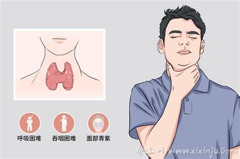 结节性甲状腺肿怎么治疗