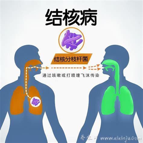 结核病是什么