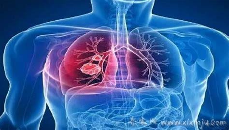 肺部结节手术的费用是多少?